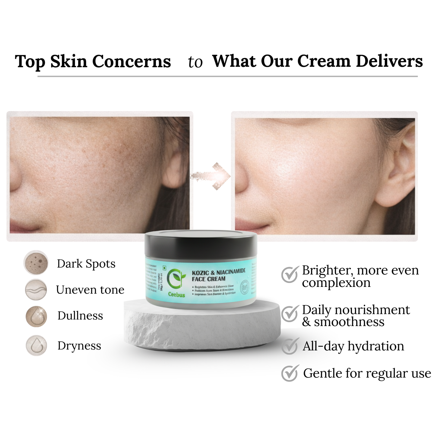 Ceebus Complete Skincare Combo, Soap with Kojic Niacinamide & Hyaluronic, 10% Niacinamide Serum 30ml, Cream, 3-Step Daily Routine for Men & Women