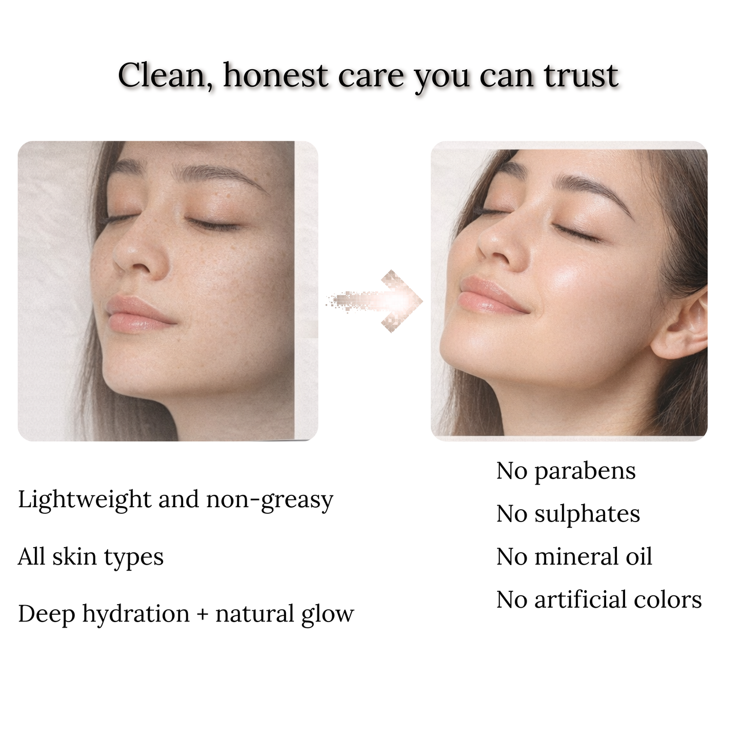 Ceebus Restore Barrier Cream with Lactobacillus Ferment, Niacinamide & Vitamin C | For Dry & Sensitive Skin | All Skin Types | 50g