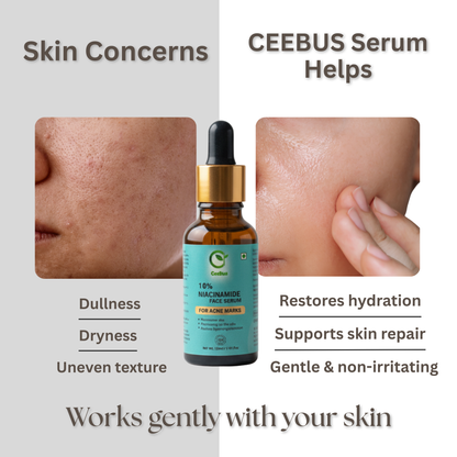 Ceebus Complete Skincare Combo, Soap with Kojic Niacinamide & Hyaluronic, 10% Niacinamide Serum 30ml, Cream, 3-Step Daily Routine for Men & Women